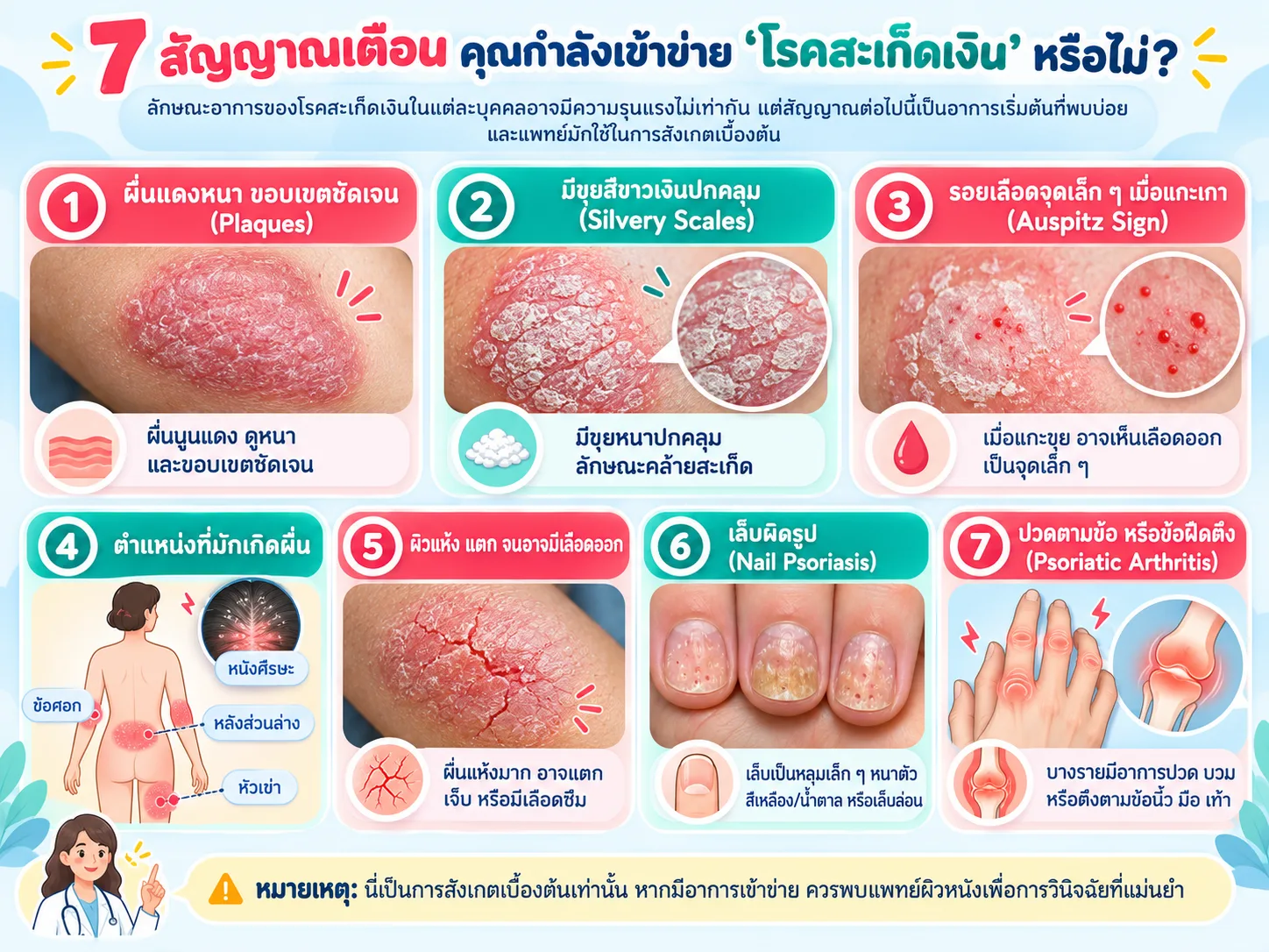 Red Bumpy Rash Shin สะเก็ดเงิน อาการเป็นยังไง? สังเกต 7 สัญญาณ ผื่นแดง ตกสะเก็ด